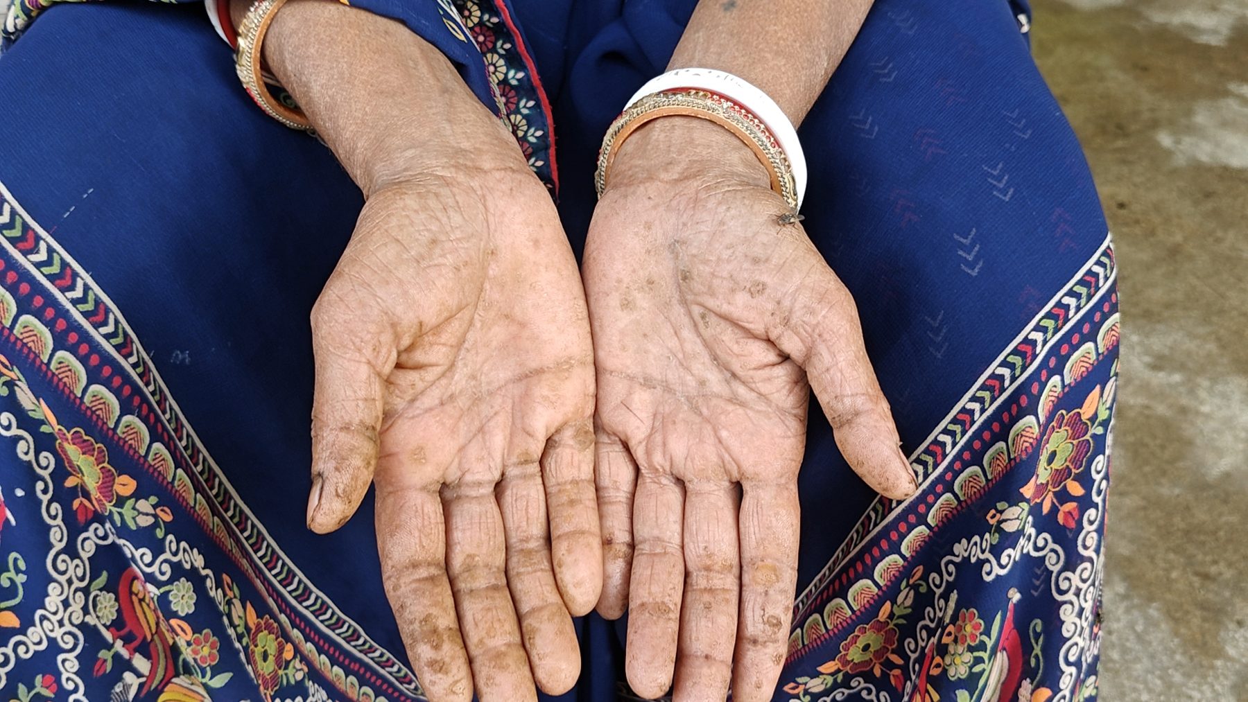 Bhagalpur, Bihar