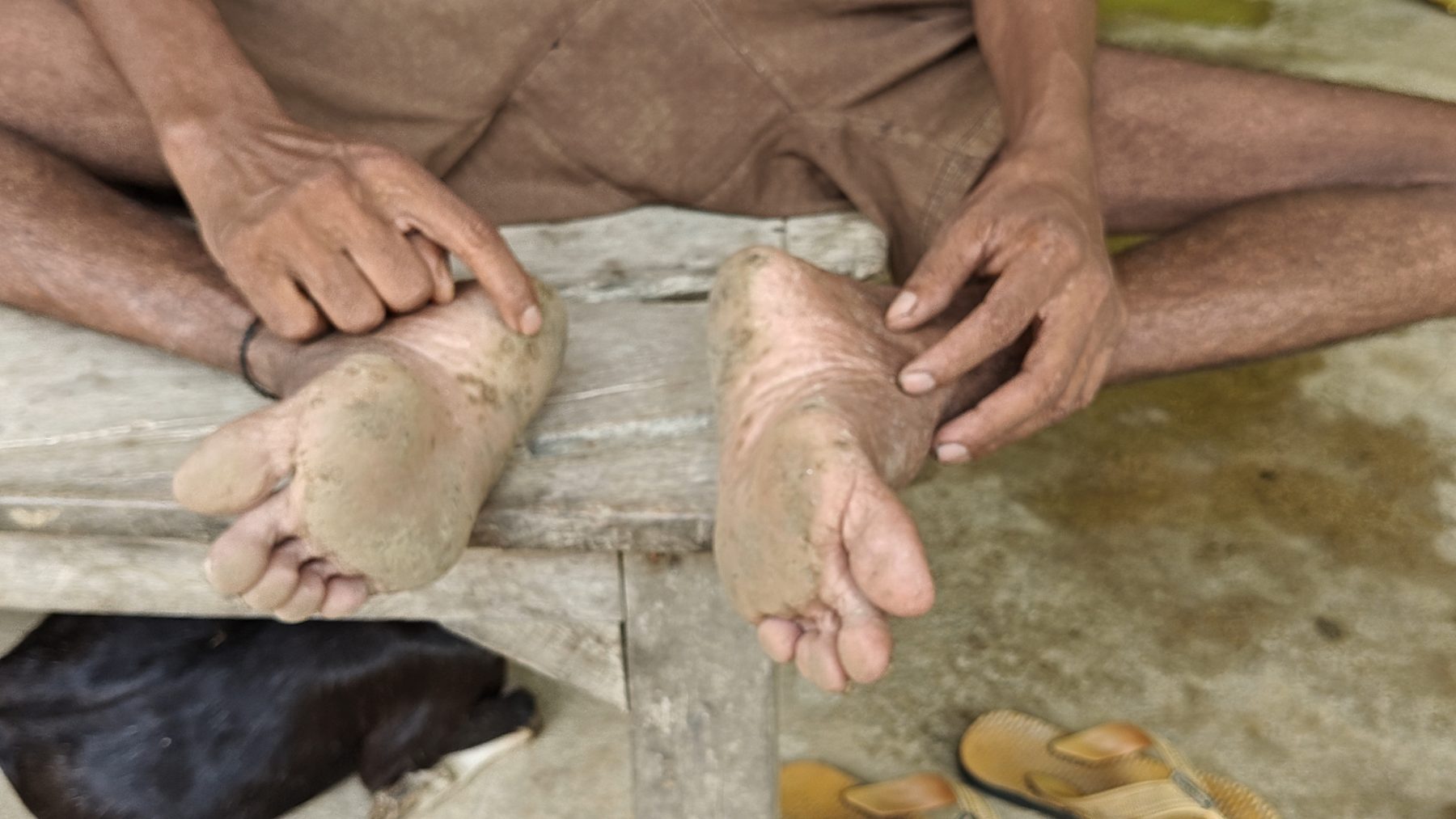 Bhagalpur, Bihar