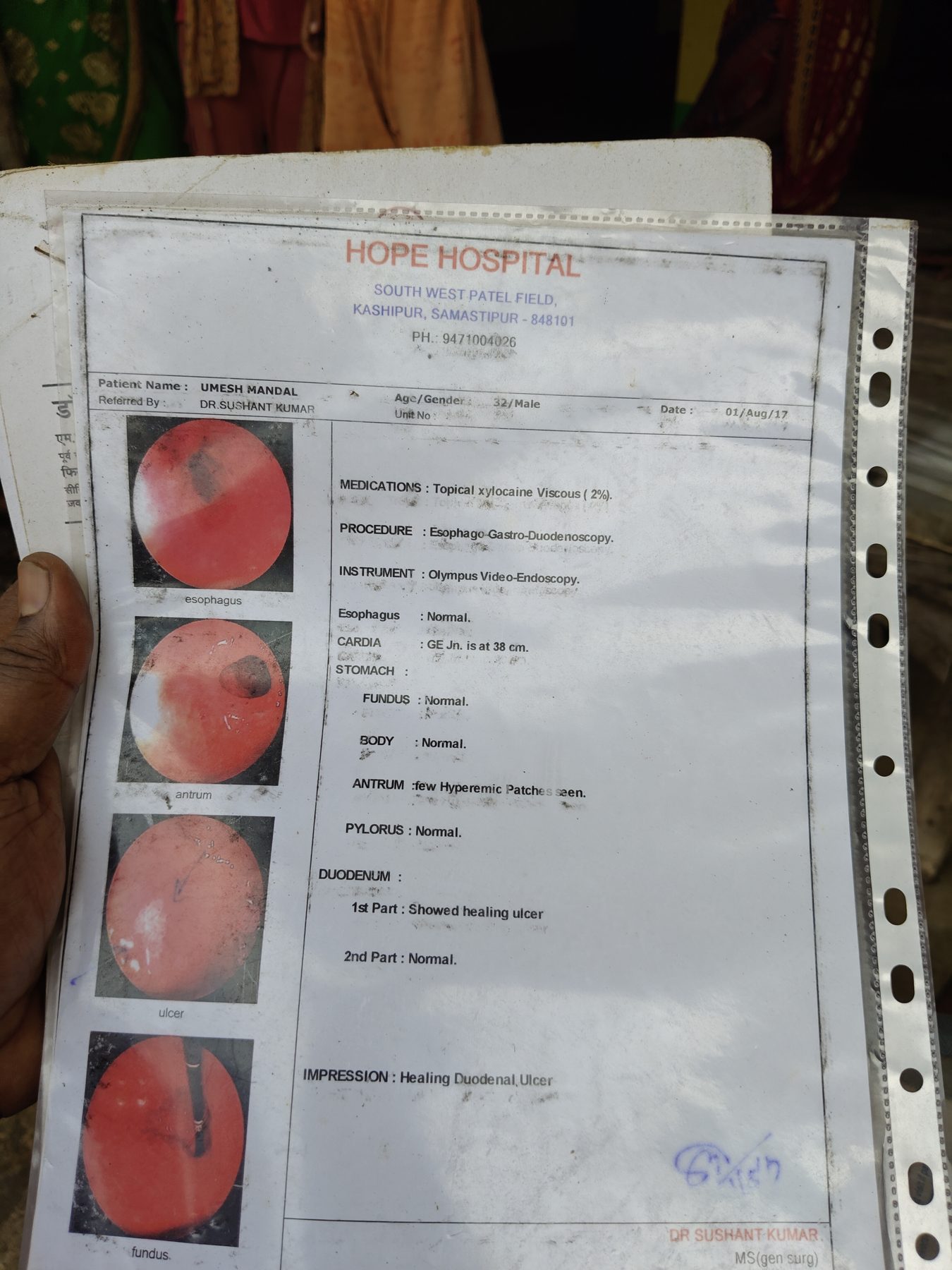 Udesh Mandal endoscopy